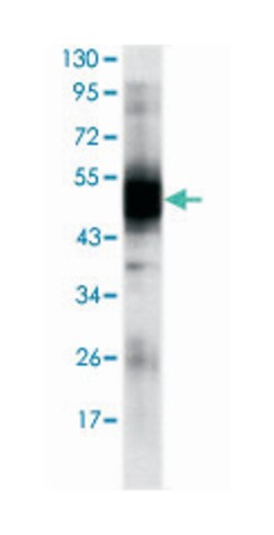 RAG2, Mouse, Clone: 4D5, Abnova 100&mu;L; Unlabeled:Antibodies, Monoclonal