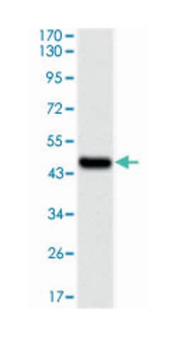 UBE2I, Mouse, Clone: 1B10, Abnova 100&mu;L; Unlabeled:Antibodies, Monoclonal