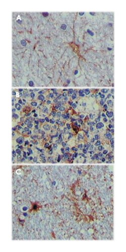 S100A1, Mouse, Clone: 2C8B8, 2C8E8, 3C8D8, Abnova 100&mu;L; Unlabeled:Antibodies,