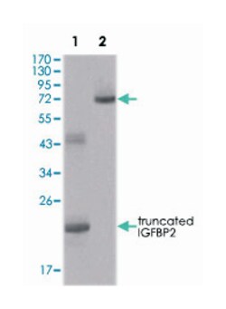IGFBP2, Mouse, Clone: 1F6F6, Abnova 100&mu;L; Unlabeled:Antibodies, Monoclonal