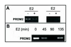PRDM2, Mouse, Clone: 33AT1045, Abnova 400 &mu;L | Buy Online | Abnova Corporation | Fisher Scientific