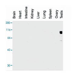 Gena (testicular germ cell-specific), Rat, Clone: TRA98, Abnova 50&mu;g;