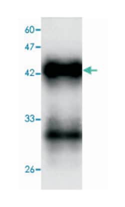 Hepatitis A virus VP1, Mouse, Clone: 54d64, Abnova 100 &mu;L | Buy Online | Abnova Corporation | Fisher Scientific