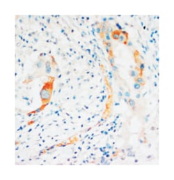 CASP2 Rabbit anti-Human, Mouse, Rat, Polyclonal Antibody, Abnova 100&mu;g;