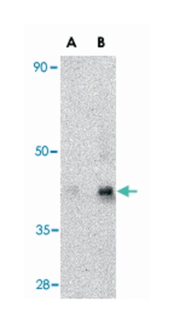 GPR44 Rabbit anti-Human, Mouse, Rat, Polyclonal Antibody, Abnova 100&mu;g;