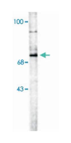 CHAT Goat anti-Human, Polyclonal Antibody, Abnova 100&mu;L; Unlabeled:Antibodies,