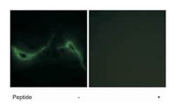 ADCY7, Rabbit, Polyclonal Antibody, Abnova 100 &mu;g | Buy Online | Abnova Corporation | Fisher Scientific