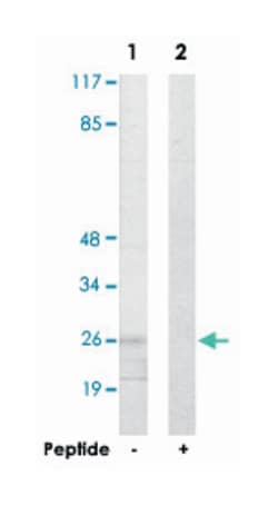 ANP32C, Rabbit, Polyclonal Antibody, Abnova 100 &mu;g | Buy Online | Abnova | Fisher Scientific