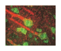 ADRBK1, Mouse, Clone: 5D5, Abnova 250 &mu;L | Buy Online | Abnova | Fisher Scientific