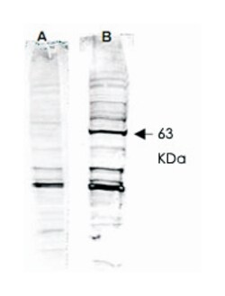 RAD52 Rabbit anti-Human, Polyclonal Antibody, Abnova 100&mu;g; Unlabeled:Antibodies,