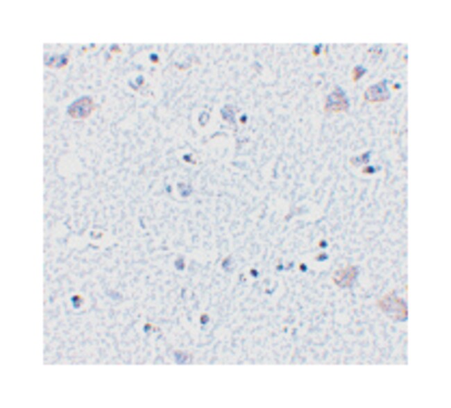 ANTI-BRSK1 ANTIBODY 100UG