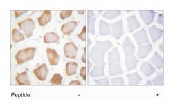 ALOX5 Rabbit anti-Human, Mouse, Rat, Polyclonal Antibody, Abnova 100 &mu;g | Buy Online | Abnova | Fisher Scientific