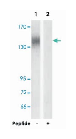 ERBB2 Rabbit anti-Human, Polyclonal Antibody, Abnova 100&mu;g; Unlabeled:Antibodies,