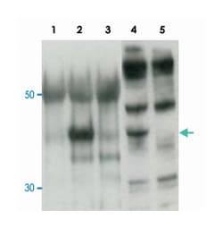 Cytip, Rabbit, Polyclonal Antibody, Abnova 100 &mu;g | Buy Online | Abnova Corporation | Fisher Scientific