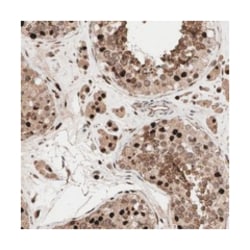 MUM1L1 Rabbit anti-Human, Polyclonal Antibody, Abnova 100 &mu;L | Buy Online | Abnova Corporation | Fisher Scientific