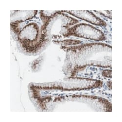 RBM47, Rabbit, Polyclonal Antibody, Abnova 100 &mu;L | Buy Online | Abnova Corporation | Fisher Scientific
