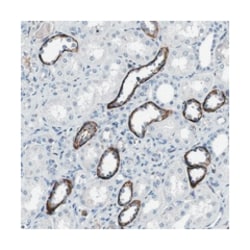 GRAMD1A Rabbit anti-Human, Polyclonal Antibody, Abnova 100&mu;L; Unlabeled:Antibodies,