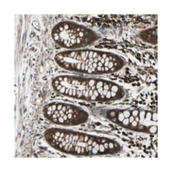 KANK4, Rabbit, Polyclonal Antibody, Abnova 100&mu;L; Unlabeled:Antibodies,