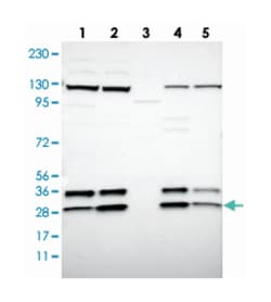 SSR3, Rabbit, Polyclonal Antibody, Abnova 100&mu;L; Unlabeled:Antibodies,