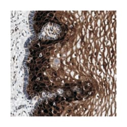CRABP1, Rabbit, Polyclonal Antibody, Abnova 100 &mu;L | Buy Online | Abnova Corporation | Fisher Scientific