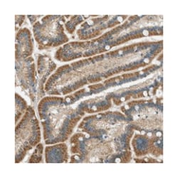 MAN2A2, Rabbit, Polyclonal Antibody, Abnova 100 &mu;L | Buy Online | Abnova Corporation | Fisher Scientific