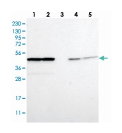 PSMC5 Rabbit anti-Human, Polyclonal Antibody, Abnova 100 &mu;L | Buy Online | Abnova Corporation | Fisher Scientific