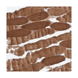 ITIH3, Rabbit, Polyclonal Antibody, Abnova 100&mu;L; Unlabeled:Antibodies,