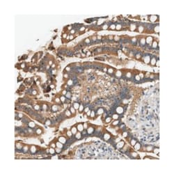 WDR31 Rabbit anti-Human, Polyclonal Antibody, Abnova 100&mu;L; Unlabeled:Antibodies,