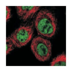 PRCC Rabbit anti-Human, Polyclonal Antibody, Abnova 100&mu;L; Unlabeled:Antibodies,