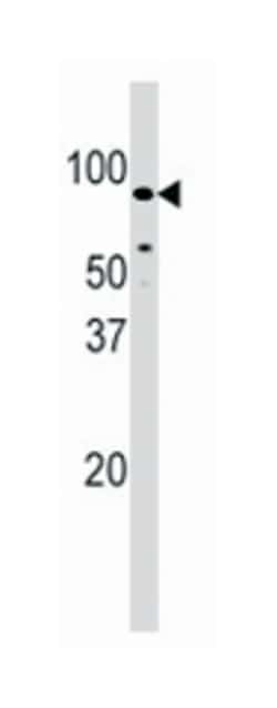 PFKM Rabbit anti-Human, Polyclonal Antibody, Abnova 400&mu;L; Unlabeled:Antibodies,