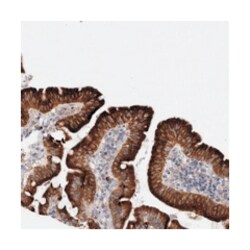 LRRC40, Rabbit, Polyclonal Antibody, Abnova 100 &mu;L | Buy Online | Abnova Corporation | Fisher Scientific