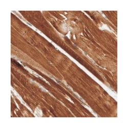 AMPD1 Rabbit anti-Human, Polyclonal Antibody, Abnova 100&mu;L; Unlabeled:Antibodies,