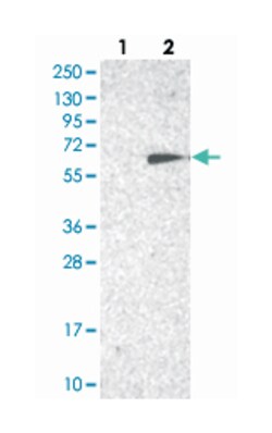 TC2N, Rabbit, Polyclonal Antibody, Abnova 100&mu;L; Unlabeled:Antibodies,