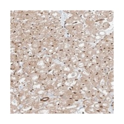 TTLL5, Rabbit, Polyclonal Antibody, Abnova 100 &mu;L | Buy Online | Abnova Corporation | Fisher Scientific