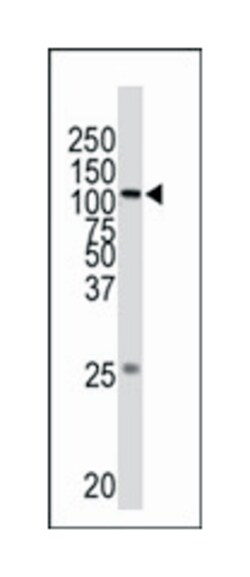 MAP3K1 Rabbit anti-Human, Polyclonal Antibody, Abnova 400&mu;L; Unlabeled:Antibodies,