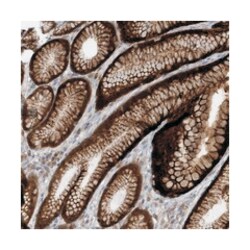 NXPH2, Rabbit, Polyclonal Antibody, Abnova 100 &mu;L | Buy Online | Abnova Corporation | Fisher Scientific