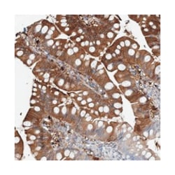 NCRNA00082, Rabbit, Polyclonal Antibody, Abnova 100&mu;L; Unlabeled:Antibodies,