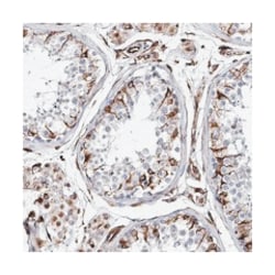 ALG1L, Rabbit, Polyclonal Antibody, Abnova 100&mu;L; Unlabeled:Antibodies,