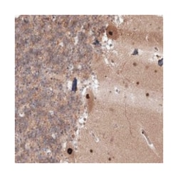 COPS4, Rabbit, Polyclonal Antibody, Abnova 100 &mu;L | Buy Online | Abnova Corporation | Fisher Scientific