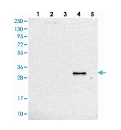 RDH16, Rabbit, Polyclonal Antibody, Abnova 100 &mu;L | Buy Online | Abnova Corporation | Fisher Scientific