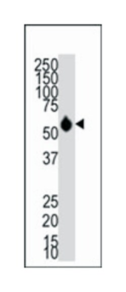 HDAC8 Rabbit anti-Human, Polyclonal Antibody, Abnova 400 &mu;L | Buy Online | Abnova Corporation | Fisher Scientific