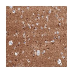 NLRP10 Rabbit anti-Human, Polyclonal Antibody, Abnova 100&mu;L; Unlabeled:Antibodies,