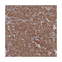 CCDC102A Rabbit anti-Human, Polyclonal Antibody, Abnova 100&mu;L; Unlabeled:Antibodies,