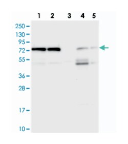 KARS Rabbit anti-Human, Polyclonal Antibody, Abnova 100 &mu;L | Buy Online | Abnova Corporation | Fisher Scientific
