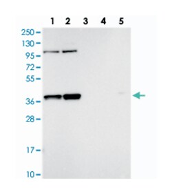 FAM131A, Rabbit, Polyclonal Antibody, Abnova 100&mu;L; Unlabeled:Antibodies,