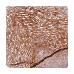 DEFB125, Rabbit, Polyclonal Antibody, Abnova 100&mu;L; Unlabeled:Antibodies,