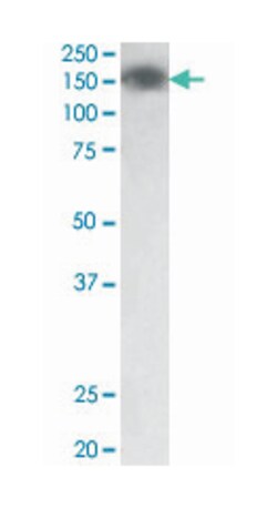 MYLK, Goat, Polyclonal Antibody, Abnova 100 &mu;g | Buy Online | Abnova Corporation | Fisher Scientific