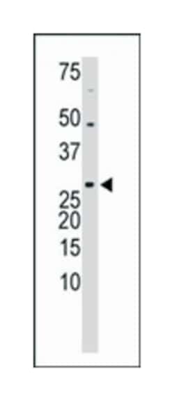 TXNL1, Rabbit, Polyclonal Antibody, Abnova 400&mu;L; Unlabeled:Antibodies,