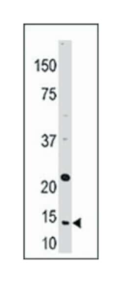 TXN Rabbit anti-Human, Polyclonal Antibody, Abnova 400 &mu;L | Buy Online | Abnova Corporation | Fisher Scientific