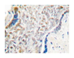 CDKN2A Rabbit anti-Human, Polyclonal Antibody, Abnova 100&mu;L; Unlabeled:Antibodies,